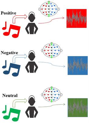 Music-evoked emotions classification using vision transformer in EEG signals